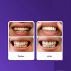 Purple Whitening And Stain-removing Tooth Plaster