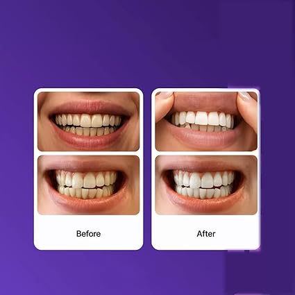 Purple Whitening And Stain-removing Tooth Plaster